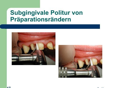 Politop - detaillierte Anwendungsbeschreibung von Dr. Horst ...