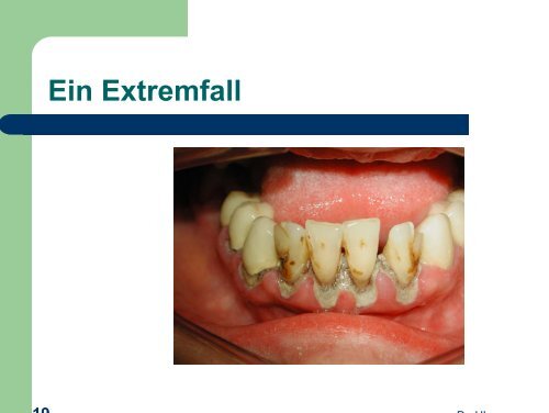 Politop - detaillierte Anwendungsbeschreibung von Dr. Horst ...