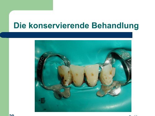 Politop - detaillierte Anwendungsbeschreibung von Dr. Horst ...