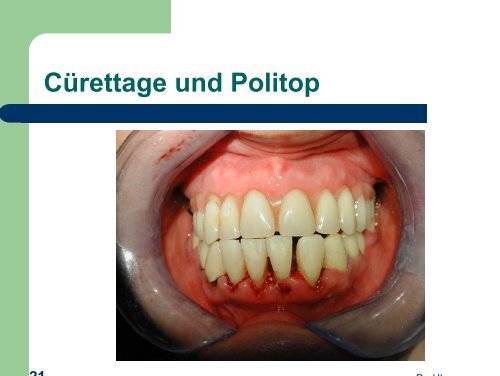 Politop - detaillierte Anwendungsbeschreibung von Dr. Horst ...