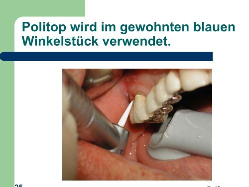 Politop - detaillierte Anwendungsbeschreibung von Dr. Horst ...