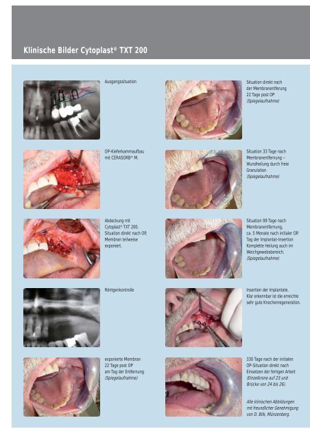 die Cytoplast-Broschüre (PDF, 950kb) - MDS-Dental