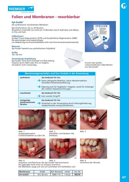 resorbierbar - MDS-Dental