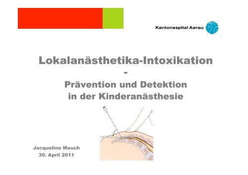 Lokalanästhetika-Intoxikation, Prävention und Detektion in der ...