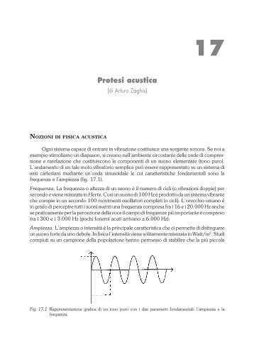 Protesi acustica - Dario Ianes