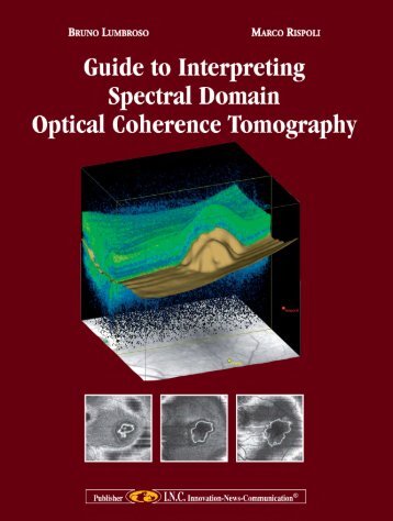 Guide to Interpreting Spectral Domain - Carl Zeiss Meditec AG