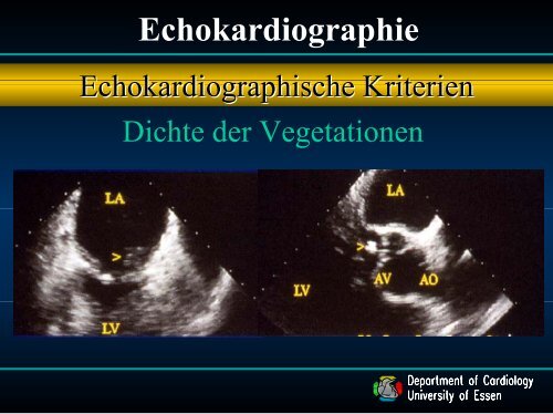 4. Vortrag Endokarditis - Dr. med. C. Naber (ca