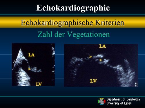 4. Vortrag Endokarditis - Dr. med. C. Naber (ca