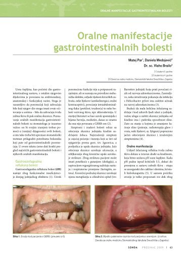 Par M [et al.] Oralne manifestacije gastrointestinalnih bolesti - sonda