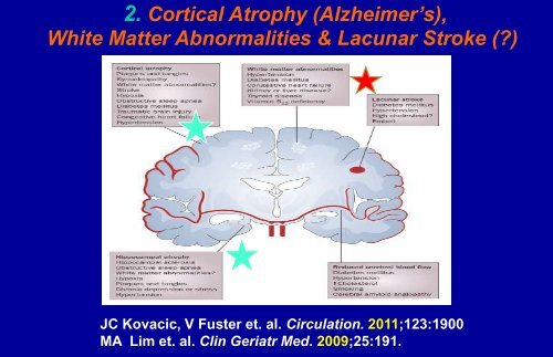 Presenter Disclosure Information Valentin Fuster, M.D., Ph.D.