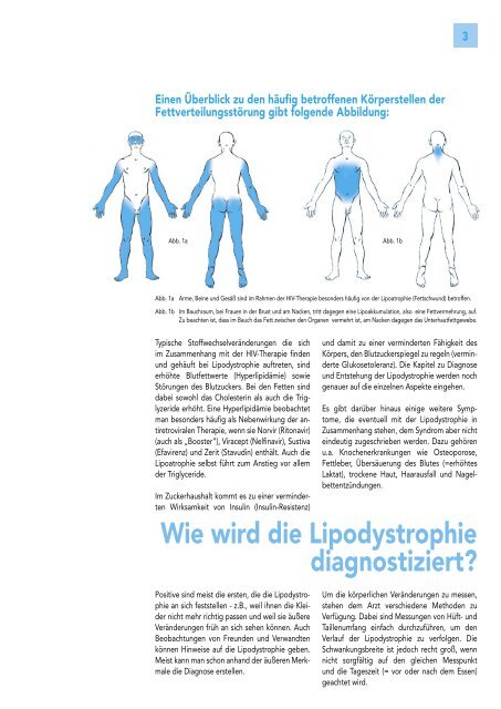 Lipoatrophie bedeutet Gewichtsverlust