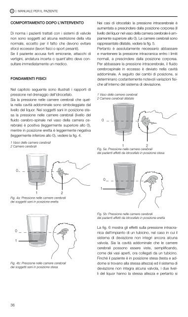 proGAV® - Christoph Miethke GmbH & Co. KG