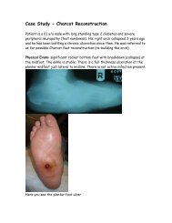 Case Study - Charcot Reconstruction