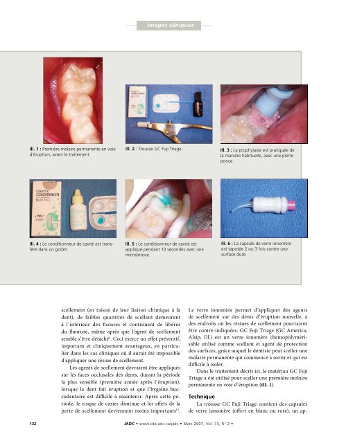 JADC - Canadian Dental Association