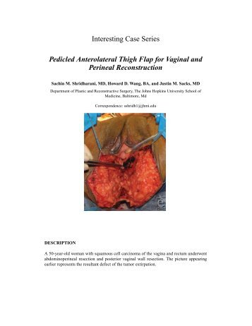 Interesting Case Series Pedicled Anterolateral Thigh Flap ... - ePlasty