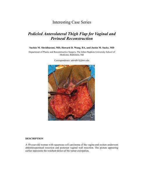 Interesting Case Series Pedicled Anterolateral Thigh Flap ... - ePlasty