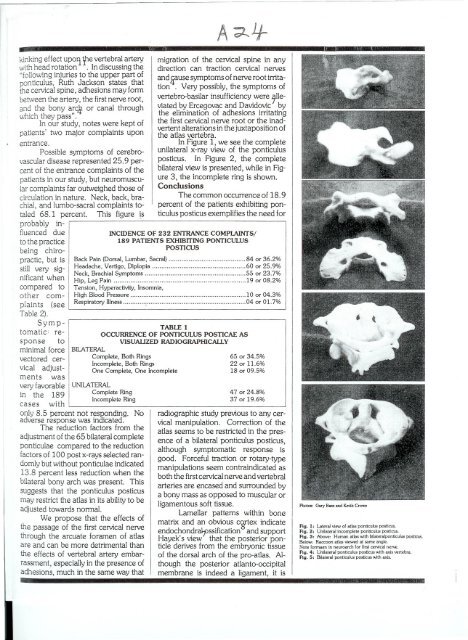 The Ponticulus Posticus Pt. 2 - Atlas Orthogonal