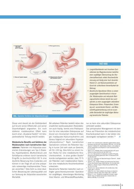 Osteoporose 1_2009