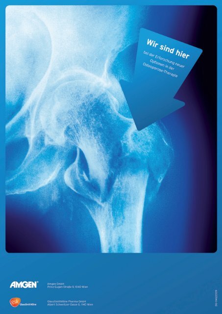 Osteoporose 1_2009