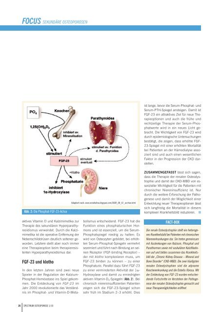 Osteoporose 1_2009