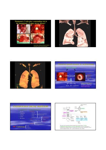 Tracheal stenosis: anatomy classification