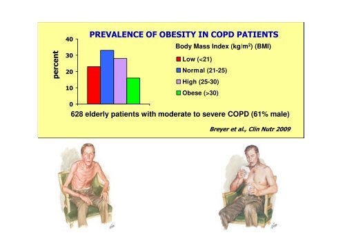 Anabolic resistance: a road map to malnutrition