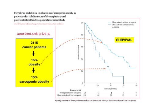 Anabolic resistance: a road map to malnutrition