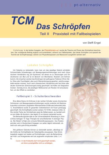 Das Schröpfen - Naturheilpraxis Steffi Engel, Heilpraktikerin