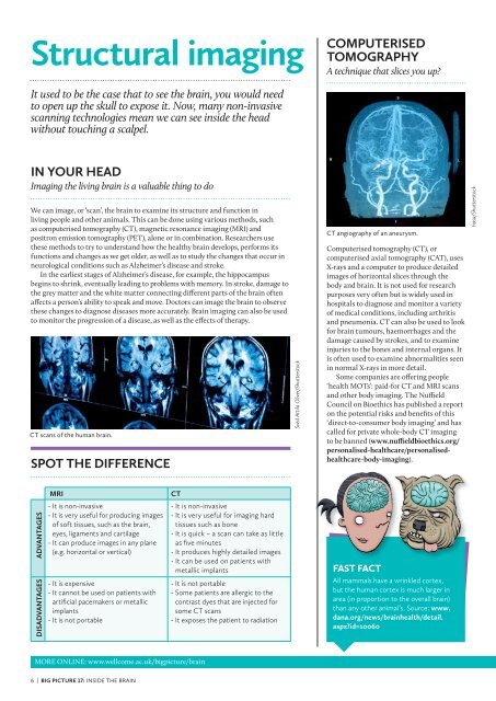 MIND-BLOWING BRAINS How research helps us look inside the brain