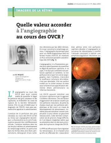 Quelle valeur accorder à l'angiographie au cours des OVCR ?