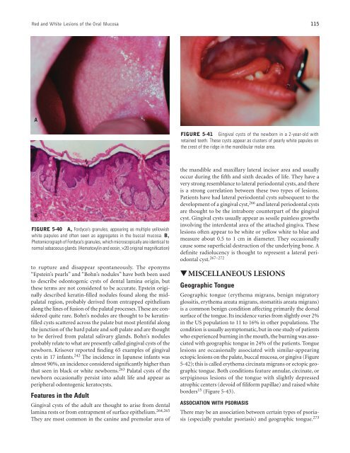 Ch05: Red and White Lesions of the Oral Mucosa