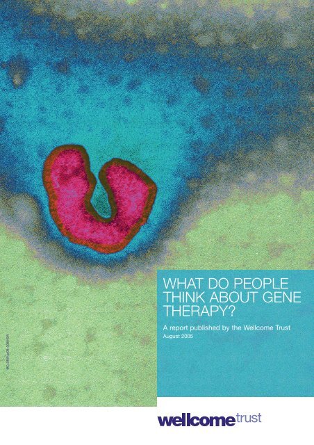 what do people think about gene therapy? - Wellcome Trust