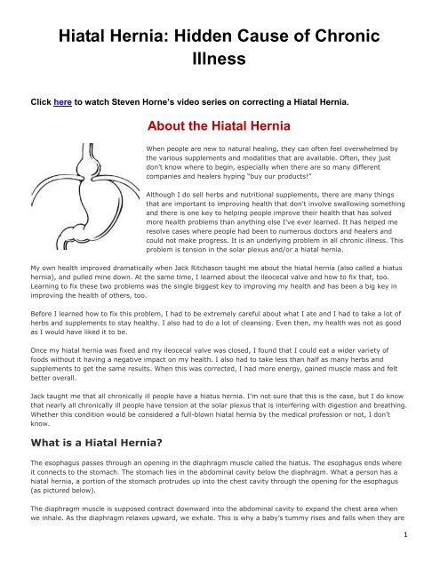 Hiatal Hernia: Hidden Cause of Chronic Illness - Balanced Concepts