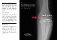 Golfers Elbow