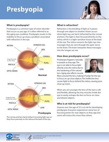 Presbyopia Fact Sheet