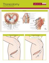 Thoracotomy Catheter Placement Guide - Moog Inc