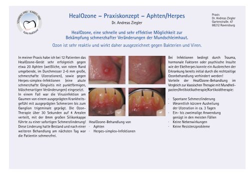 HealOzone - in der Zahnarztpraxis Kalla, Basel