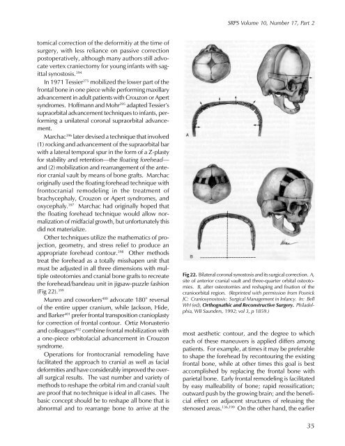 Craniofacial Anomalies, Part 2 - Plastic Surgery Internal