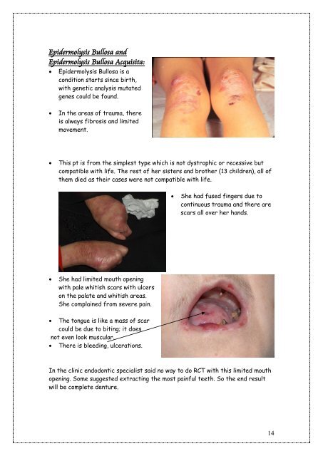 Oral Ulceration and Vesiculobullous Diseases (Lab). - my toothy