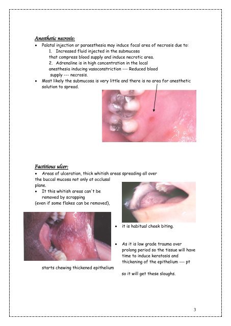 Oral Ulceration and Vesiculobullous Diseases (Lab). - my toothy