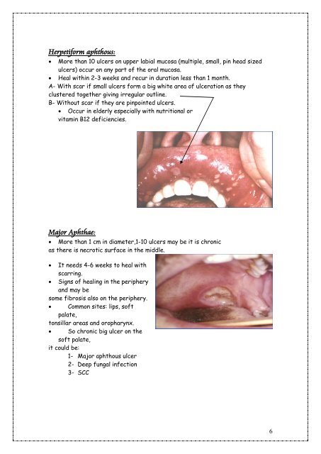 Oral Ulceration and Vesiculobullous Diseases (Lab). - my toothy