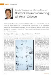 Akromioklavikularstabilisierung bei akuten Läsionen - Dr. Klaus Dann