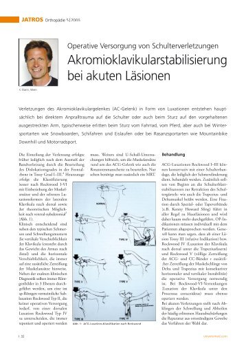 Akromioklavikularstabilisierung bei akuten Läsionen - Dr. Klaus Dann