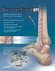 Knotless TightRope® - Arthrex