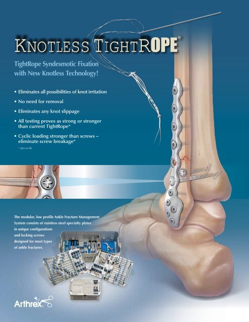 Knotless TightRope® - Arthrex