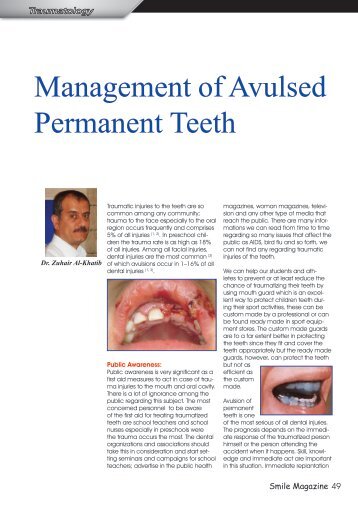 Management_of_Avulsed_Permanent_Teeth