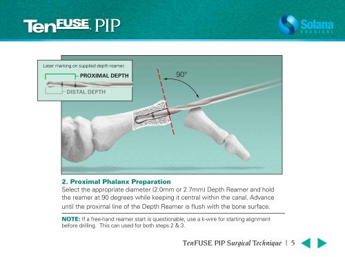 PIP Surgical Technique Brochure (Mobile) - Solana Surgical