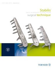 Stabilis™ Surgical Technique (PDF) - Tornier DX