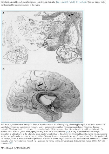 Surgical Anatomy of Supratentorial Midline Lesions