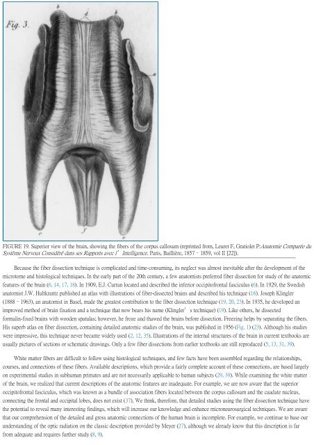 Surgical Anatomy of Supratentorial Midline Lesions